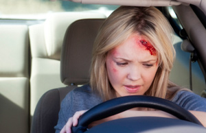 a female driver with facial injuries after an accident