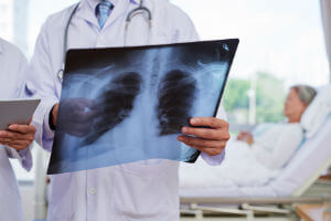 pneumonia misdiagnosis medical negligence 