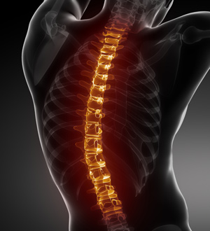 an xray of a spinal cord