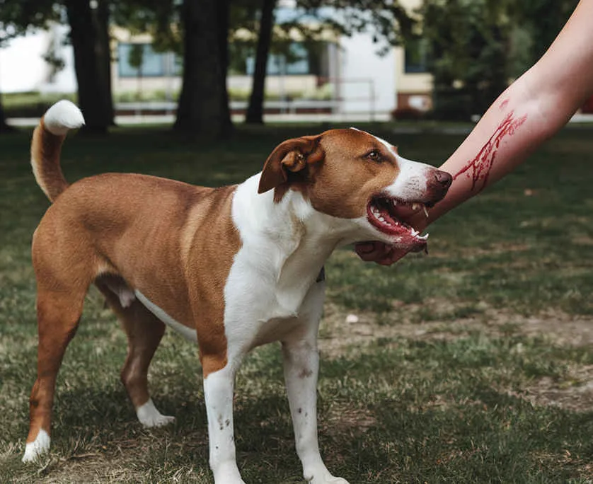 Dog Attack Attorney West Palm Beach Dog Attack Attorney West Palm Beach