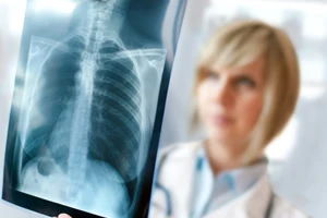 Rib and Torso <a href='/' title='injury attorneys'> injury attorneys</a>